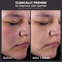Paula's Choice Skin Perfecting 2% BHA Liquid Salicylic Acid Exfoliant, Gentle Facial Exfoliator for Blackheads, Large Pores, Wrinkles & Fine Lines, Travel Size